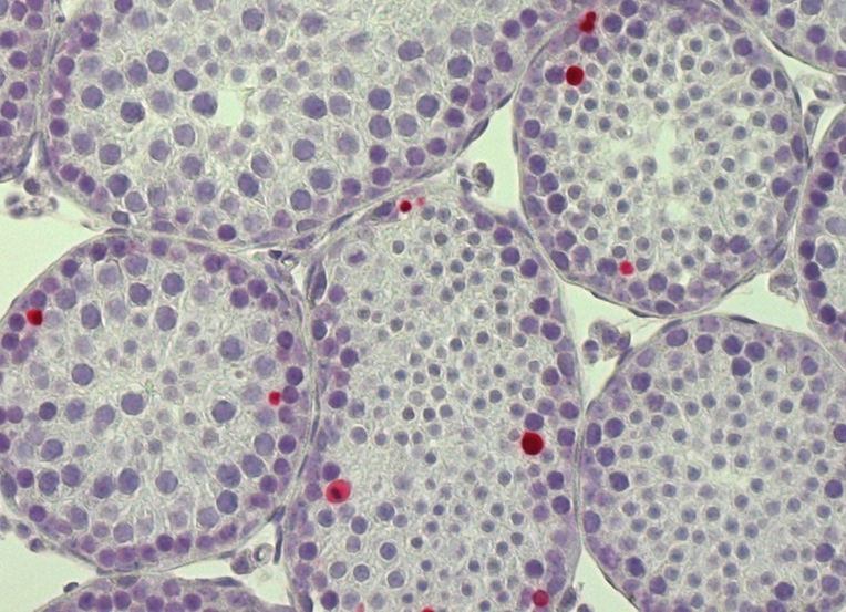Coupe de de testicule de souris avec dtection des cellules en apoptose (mort cellulaire) par mthode TUNEL